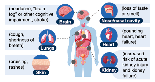 Figure 3. Symptoms of long COVID